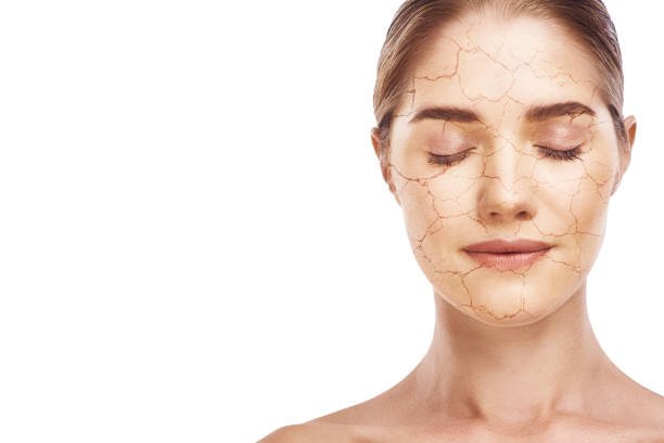 HOME REMEDIES FOR DRY SKIN