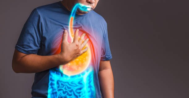 Home Remedies for Heartburn: 8 Ways to Get Rid of Acid Reflux ( ACIDITY )