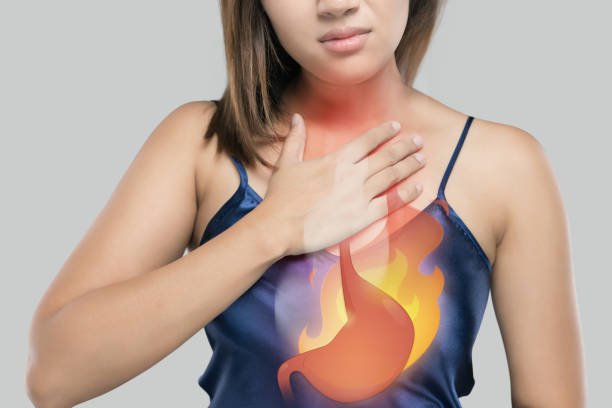  Foods That Help Acid Reflux and Heartburn